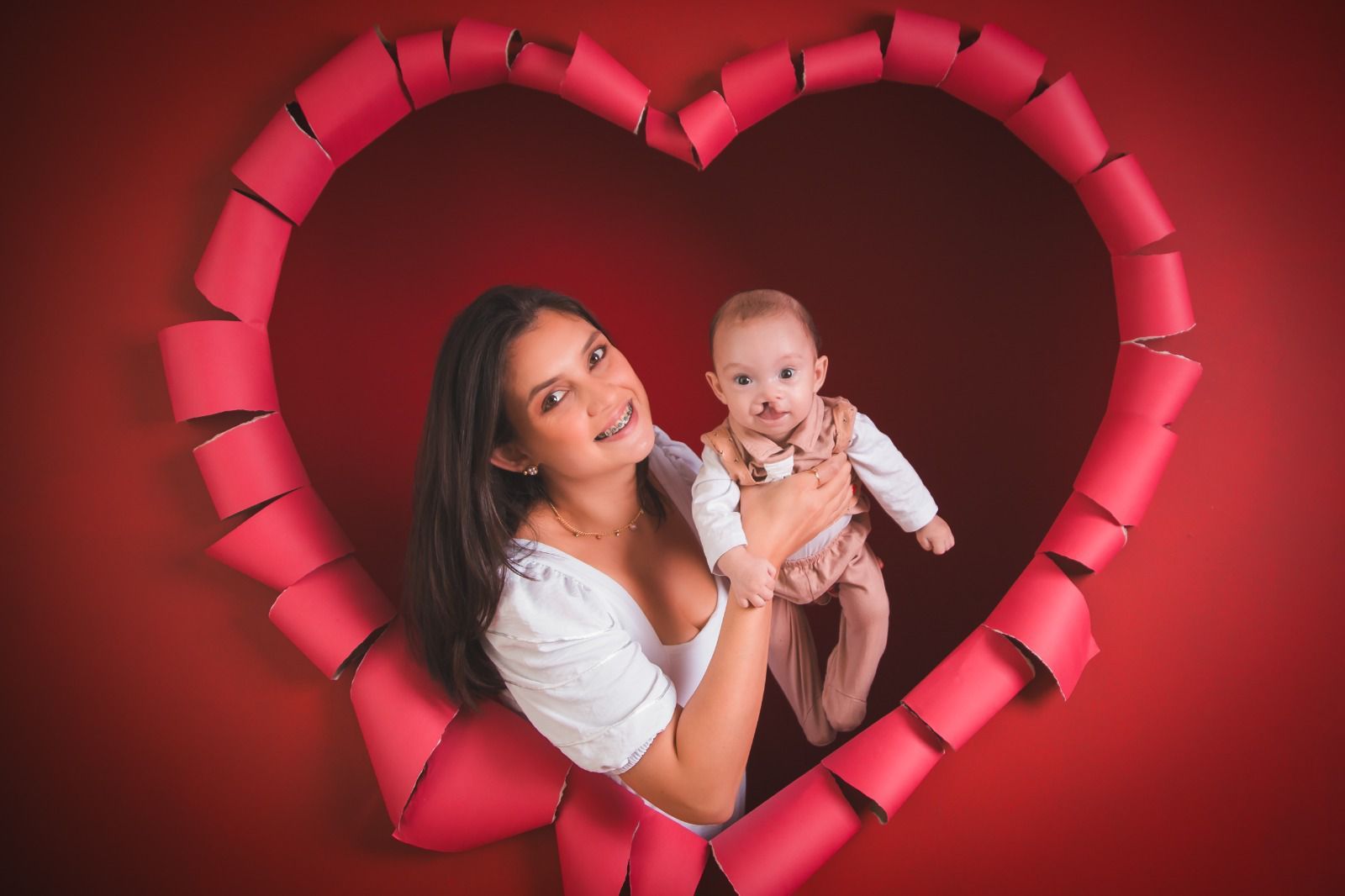 Fissura Lábio Palatina: História de Theo e a Importância da Conscientização